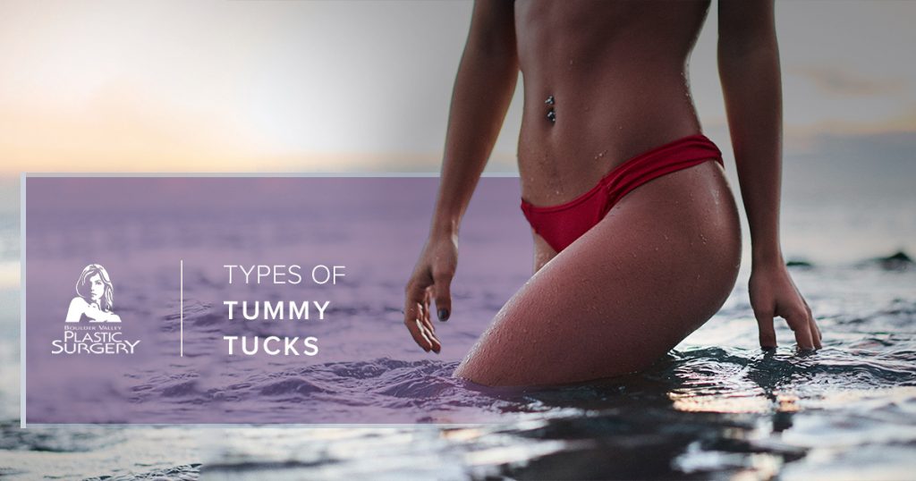 Body Plastic Surgery Boulder: Types of Tummy Tucks