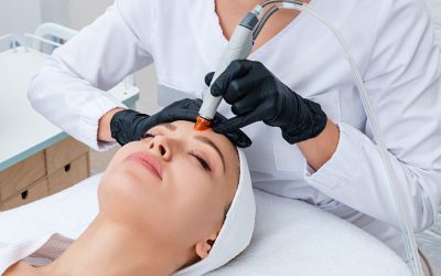 Microneedling vs. Laser Treatments: Which is Best for Skin Rejuvenation?