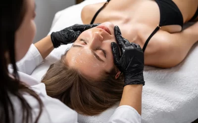 MicroLaser Peel for Acne Scars: Can It Really Smooth Your Skin?